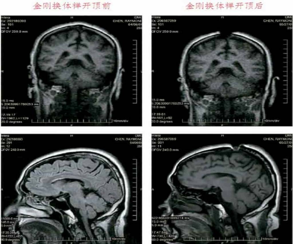 祿東贊尊者第四世慈仁嘉措法王